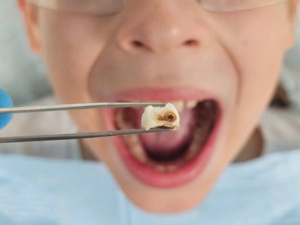 Best Emergency Dental Services for Seniors in Glen Allen, VA