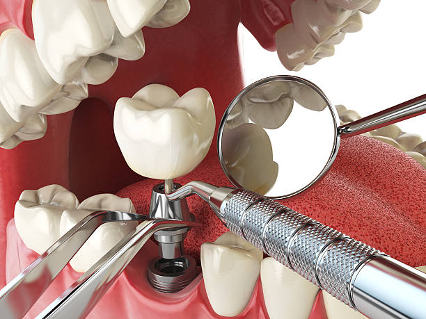 Best Weekend Emergency Dentist in Glen Allen, VA